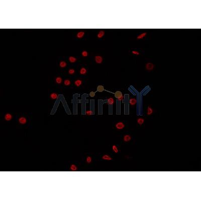 AF0302 staining K562 by IF/ICC. The sample were fixed with PFA and permeabilized in 0.1% Triton X-100,then blocked in 10% serum for 45 minutes at 25¡ãC. The primary antibody was diluted at 1/200 and incubated with the sample for 1 hour at 37¡ãC. An  Alexa Fluor 594 conjugated goat anti-rabbit IgG (H+L) Ab, diluted at 1/600, was used as the secondary antibod