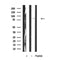 Western blot analysis of TORC2 antibody expression in A431 cells lysates.The lane on the left is treated with the antigen-specific peptide.