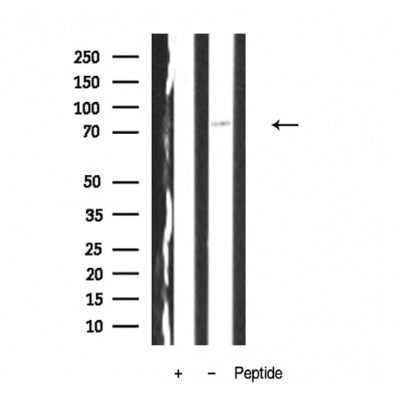 Western blot analysis of TORC2 antibody expression in A431 cells lysates.The lane on the left is treated with the antigen-specific peptide.