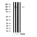 Western blot analysis of extracts from Rat  brain, using Niban Antibody. The lane on the left was treated with blocking peptide.