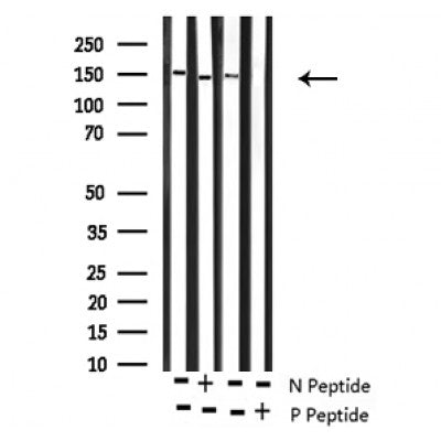 Western blot analysis of Phospho-ROCK2 (Tyr722) antibody expression in Rat brain and mouse lung tissues lysates.