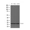 AF4009 staining 293T by IF/ICC. The sample were fixed with PFA and permeabilized in 0.1% Triton X-100,then blocked in 10% serum for 45 minutes at 25¡ãC. The primary antibody was diluted at 1/200 and incubated with the sample for 1 hour at 37¡ãC. An  Alexa Fluor 594 conjugated goat anti-rabbit IgG (H+L) Ab, diluted at 1/600, was used as the secondary antibod