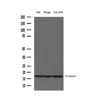 AF4009 staining 293T by IF/ICC. The sample were fixed with PFA and permeabilized in 0.1% Triton X-100,then blocked in 10% serum for 45 minutes at 25¡ãC. The primary antibody was diluted at 1/200 and incubated with the sample for 1 hour at 37¡ãC. An  Alexa Fluor 594 conjugated goat anti-rabbit IgG (H+L) Ab, diluted at 1/600, was used as the secondary antibod