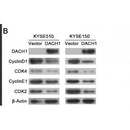 Western blot analysis of extracts from HUVEC cells using CDK4 Antibody