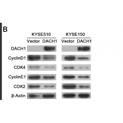 Western blot analysis of extracts from HUVEC cells using CDK4 Antibody