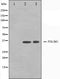 Western blot analysis on K562 and Jurkat cell lysate using CLIM1 Antibody.The lane on the left is treated with the antigen-specific peptide.