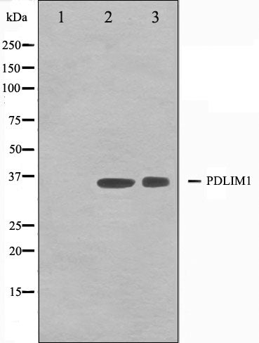 Western blot analysis on K562 and Jurkat cell lysate using CLIM1 Antibody.The lane on the left is treated with the antigen-specific peptide.