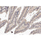 AF0303 at 1/100 staining human colon tissue sections by IHC-P. The tissue was formaldehyde fixed and a heat mediated antigen retrieval step in citrate buffer was performed. The tissue was then blocked and incubated with the antibody for 1.5 hours at 22¡ãC. An HRP conjugated goat anti-rabbit antibody was used as the secondary