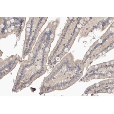 AF0303 at 1/100 staining human colon tissue sections by IHC-P. The tissue was formaldehyde fixed and a heat mediated antigen retrieval step in citrate buffer was performed. The tissue was then blocked and incubated with the antibody for 1.5 hours at 22¡ãC. An HRP conjugated goat anti-rabbit antibody was used as the secondary