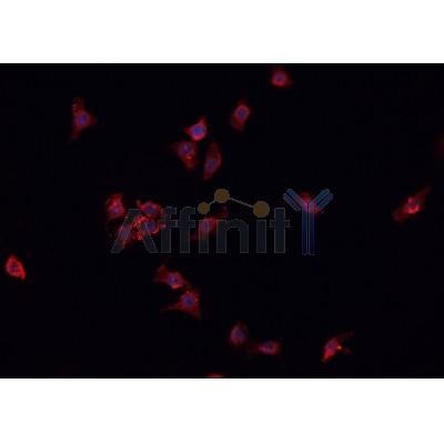 AF0303 staining HeLa cells by IF/ICC. The sample were fixed with PFA and permeabilized in 0.1% Triton X-100,then blocked in 10% serum for 45 minutes at 25¡ãC. The primary antibody was diluted at 1/200 and incubated with the sample for 1 hour at 37¡ãC. An  Alexa Fluor 594 conjugated goat anti-rabbit IgG (H+L) antibody(Cat.