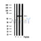Western blot analysis of extracts from HepG2 and 293 cells using PKM1/2