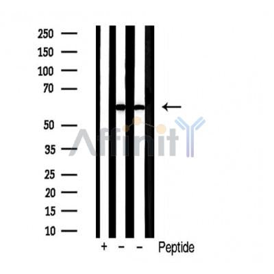 Western blot analysis of extracts from HepG2 and 293 cells using PKM1/2