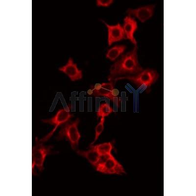 Western blot analysis of extracts from mouse spleen, rat brain, using ERAB Antibody.