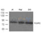 Western blot analysis of extract from JK, Raji and 293 cells using FOXP2 antibody.