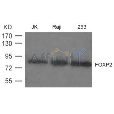 Western blot analysis of extract from JK, Raji and 293 cells using FOXP2 antibody.