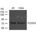 Western blot analysis of extract from JK and Hela cells using FOXP4 antibody.