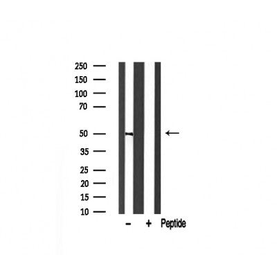 Western blot analysis of DR4 expression in rat spleen lysate