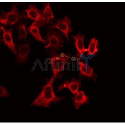 AF0304 staining Hela by IF/ICC. The sample were fixed with PFA and permeabilized in 0.1% Triton X-100,then blocked in 10% serum for 45 minutes at 25¡ãC. The primary antibody was diluted at 1/200 and incubated with the sample for 1 hour at 37¡ãC. An  Alexa Fluor 594 conjugated goat anti-rabbit IgG (H+L) Ab, diluted at 1/600, was used as the secondary antibod