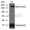 AF4081 staining U87 by IF/ICC. The sample were fixed with PFA and permeabilized in 0.1% Triton X-100,then blocked in 10% serum for 45 minutes at 25¡ãC. The primary antibody was diluted at 1/200 and incubated with the sample for 1 hour at 37¡ãC. An  Alexa Fluor 594 conjugated goat anti-rabbit IgG (H+L) Ab, diluted at 1/600, was used as the secondary antibod