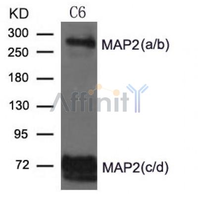 AF4081 staining U87 by IF/ICC. The sample were fixed with PFA and permeabilized in 0.1% Triton X-100,then blocked in 10% serum for 45 minutes at 25¡ãC. The primary antibody was diluted at 1/200 and incubated with the sample for 1 hour at 37¡ãC. An  Alexa Fluor 594 conjugated goat anti-rabbit IgG (H+L) Ab, diluted at 1/600, was used as the secondary antibod