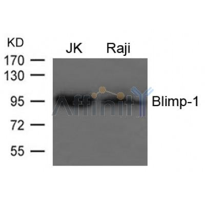 AF4088 staining HEPG2 cells by ICC/IF. Cells were fixed with PFA and permeabilized in 0.1% saponin prior to blocking in 10% serum for 45 minutes at 37¡ãC. The primary antibody was diluted 1/200 and incubated with the sample for 1 hour at 37¡ãC. A  Alexa Fluor 594 conjugated goat polyclonal to rabbit IgG (H+L), diluted 1/600 was used as secondary antibod