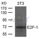 AF4091 staining HeLa by IF/ICC. The sample were fixed with PFA and permeabilized in 0.1% Triton X-100,then blocked in 10% serum for 45 minutes at 25¡ãC. The primary antibody was diluted at 1/200 and incubated with the sample for 1 hour at 37¡ãC. An  Alexa Fluor 594 conjugated goat anti-rabbit IgG (H+L) Ab, diluted at 1/600, was used as the secondary antibod