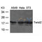 AF4112 at 1/100 staining human liver tissue sections by IHC-P. The tissue was formaldehyde fixed and a heat mediated antigen retrieval step in citrate buffer was performed. The tissue was then blocked and incubated with the antibody for 1.5 hours at 22¡ãC. An HRP conjugated goat anti-rabbit antibody was used as the secondary
