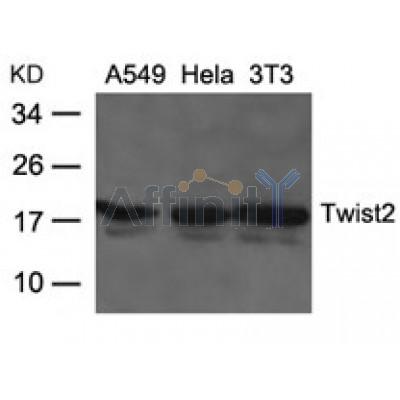 AF4112 at 1/100 staining human liver tissue sections by IHC-P. The tissue was formaldehyde fixed and a heat mediated antigen retrieval step in citrate buffer was performed. The tissue was then blocked and incubated with the antibody for 1.5 hours at 22¡ãC. An HRP conjugated goat anti-rabbit antibody was used as the secondary