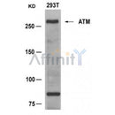 AF4119 staining Hela by IF/ICC. The sample were fixed with PFA and permeabilized in 0.1% Triton X-100,then blocked in 10% serum for 45 minutes at 25¡ãC. The primary antibody was diluted at 1/200 and incubated with the sample for 1 hour at 37¡ãC. An  Alexa Fluor 594 conjugated goat anti-rabbit IgG (H+L) Ab, diluted at 1/600, was used as the secondary antibod