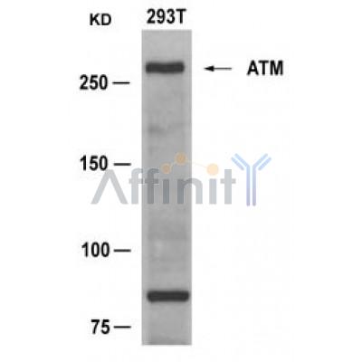AF4119 staining Hela by IF/ICC. The sample were fixed with PFA and permeabilized in 0.1% Triton X-100,then blocked in 10% serum for 45 minutes at 25¡ãC. The primary antibody was diluted at 1/200 and incubated with the sample for 1 hour at 37¡ãC. An  Alexa Fluor 594 conjugated goat anti-rabbit IgG (H+L) Ab, diluted at 1/600, was used as the secondary antibod