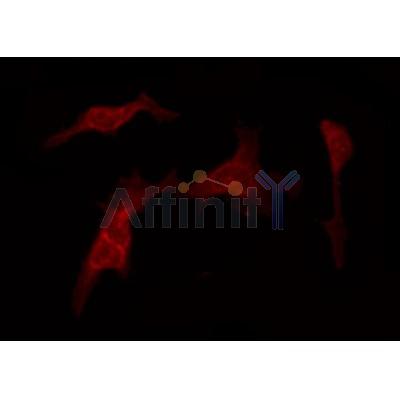 AF0305 staining NIH-3T3 by IF/ICC. The sample were fixed with PFA and permeabilized in 0.1% Triton X-100,then blocked in 10% serum for 45 minutes at 25¡ãC. The primary antibody was diluted at 1/200 and incubated with the sample for 1 hour at 37¡ãC. An  Alexa Fluor 594 conjugated goat anti-rabbit IgG (H+L) Ab, diluted at 1/600, was used as the secondary antibod