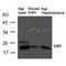 Western blot analysis of extract from Rat brain, Mouse brain and Rat hippocampus Tissue using MBP Antibody