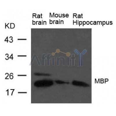 Western blot analysis of extract from Rat brain, Mouse brain and Rat hippocampus Tissue using MBP Antibody