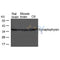 AF4095 staining LOVO by IF/ICC. The sample were fixed with PFA and permeabilized in 0.1% Triton X-100,then blocked in 10% serum for 45 minutes at 25¡ãC. The primary antibody was diluted at 1/200 and incubated with the sample for 1 hour at 37¡ãC. An  Alexa Fluor 594 conjugated goat anti-rabbit IgG (H+L) Ab, diluted at 1/600, was used as the secondary antibod