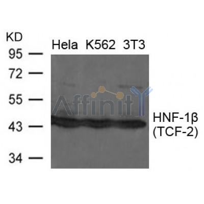 Western blot analysis of extracts from Hela, K562 and 3T3 cells using HNF-1b(TCF-2) Antibody