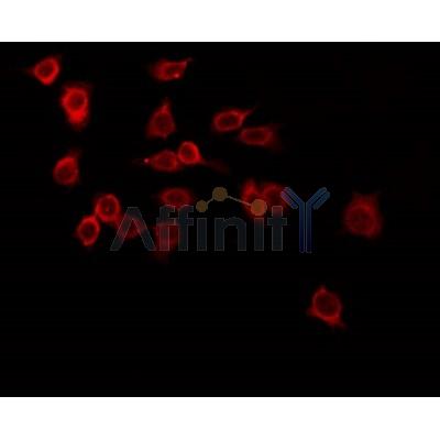 AF0307 staining LOVO by IF/ICC. The sample were fixed with PFA and permeabilized in 0.1% Triton X-100,then blocked in 10% serum for 45 minutes at 25¡ãC. The primary antibody was diluted at 1/200 and incubated with the sample for 1 hour at 37¡ãC. An  Alexa Fluor 594 conjugated goat anti-rabbit IgG (H+L) Ab, diluted at 1/600, was used as the secondary antibod