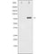 AF1017 at 1/100 staining Human breast cancer tissue by IHC-P. The sample was formaldehyde fixed and a heat mediated antigen retrieval step in citrate buffer was performed. The sample was then blocked and incubated with the antibody for 1.5 hours at 22¡ãC. An HRP conjugated goat anti-rabbit antibody was used as the secondary