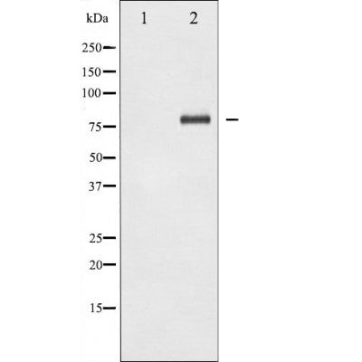 AF1017 at 1/100 staining Human breast cancer tissue by IHC-P. The sample was formaldehyde fixed and a heat mediated antigen retrieval step in citrate buffer was performed. The sample was then blocked and incubated with the antibody for 1.5 hours at 22¡ãC. An HRP conjugated goat anti-rabbit antibody was used as the secondary