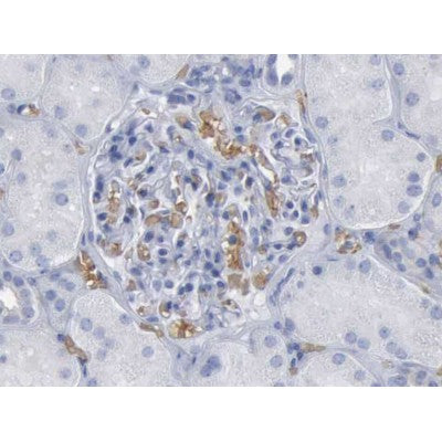 AF1027 staining HepG2 by IF/ICC. The sample were fixed with PFA and permeabilized in 0.1% Triton X-100,then blocked in 10% serum for 45 minutes at 25¡ãC. The primary antibody was diluted at 1/200 and incubated with the sample for 1 hour at 37¡ãC. An  Alexa Fluor 594 conjugated goat anti-rabbit IgG (H+L) Ab, diluted at 1/600, was used as the secondary antibod