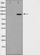 Western blot analysis on HepG2 cell lysate using DLGP1 Antibody.The lane on the left is treated with the antigen-specific peptide.