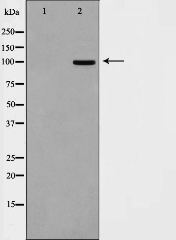 Western blot analysis on HepG2 cell lysate using DLGP1 Antibody.The lane on the left is treated with the antigen-specific peptide.