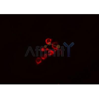 AF0308 staining MCF-7 cells by IF/ICC. The sample were fixed with PFA and permeabilized in 0.1% Triton X-100,then blocked in 10% serum for 45 minutes at 25¡ãC. The primary antibody was diluted at 1/200 and incubated with the sample for 1 hour at 37¡ãC. An  Alexa Fluor 594 conjugated goat anti-rabbit IgG (H+L) antibody(Cat.