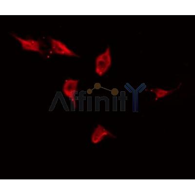 AF0310 staining HuvEc by IF/ICC. The sample were fixed with PFA and permeabilized in 0.1% Triton X-100,then blocked in 10% serum for 45 minutes at 25¡ãC. The primary antibody was diluted at 1/200 and incubated with the sample for 1 hour at 37¡ãC. An  Alexa Fluor 594 conjugated goat anti-rabbit IgG (H+L) Ab, diluted at 1/600, was used as the secondary antibod