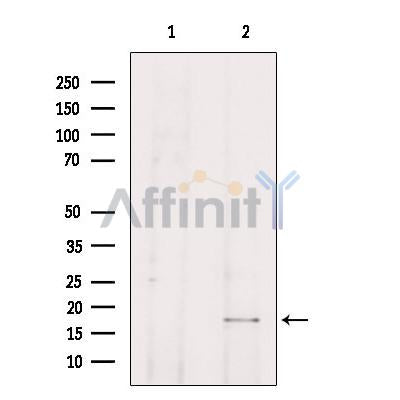 Western blot analysis of extracts from HepG2, using TP53I11 Antibody. Lane 1 was treated with the blocking peptide.
