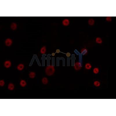 AF0311 staining K562 by IF/ICC. The sample were fixed with PFA and permeabilized in 0.1% Triton X-100,then blocked in 10% serum for 45 minutes at 25¡ãC. The primary antibody was diluted at 1/200 and incubated with the sample for 1 hour at 37¡ãC. An  Alexa Fluor 594 conjugated goat anti-rabbit IgG (H+L) Ab, diluted at 1/600, was used as the secondary antibod
