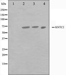 Western blot analysis on Jurkat,A549 and HuvEc cell lysate using HEC1 Antibody.The lane on the left is treated with the antigen-specific peptide.