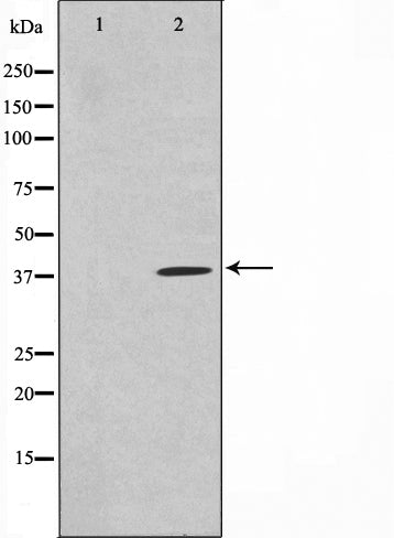 Western blot analysis on HuvEc cell lysate using TNFSF11 Antibody.The lane on the left is treated with the antigen-specific peptide.