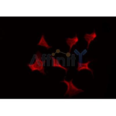AF0315 staining 293 by IF/ICC. The sample were fixed with PFA and permeabilized in 0.1% Triton X-100,then blocked in 10% serum for 45 minutes at 25¡ãC. The primary antibody was diluted at 1/200 and incubated with the sample for 1 hour at 37¡ãC. An  Alexa Fluor 594 conjugated goat anti-rabbit IgG (H+L) Ab, diluted at 1/600, was used as the secondary antibod