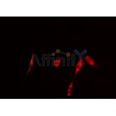 AF0317 staining 293 cells by IF/ICC. The sample were fixed with PFA and permeabilized in 0.1% Triton X-100,then blocked in 10% serum for 45 minutes at 25¡ãC. The primary antibody was diluted at 1/200 and incubated with the sample for 1 hour at 37¡ãC. An  Alexa Fluor 594 conjugated goat anti-rabbit IgG (H+L) antibody(Cat.