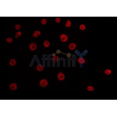 AF0319 staining A549 by IF/ICC. The sample were fixed with PFA and permeabilized in 0.1% Triton X-100,then blocked in 10% serum for 45 minutes at 25¡ãC. The primary antibody was diluted at 1/200 and incubated with the sample for 1 hour at 37¡ãC. An  Alexa Fluor 594 conjugated goat anti-rabbit IgG (H+L) Ab, diluted at 1/600, was used as the secondary antibod